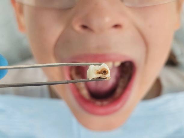 Best Pediatric Emergency Dentist in Gatesville, TX