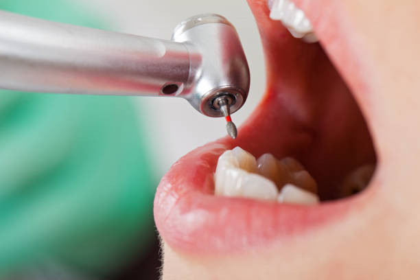 Best Emergency Broken Tooth Repair in Gatesville, TX